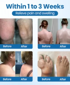 NovaRX® BPC-157 Joint Repair Cream