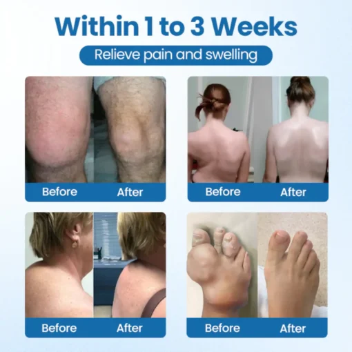 NovaRX® BPC-157 Joint Repair Cream