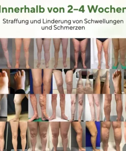 NovaRX® FluidEase Beintherapie-Ödemcreme