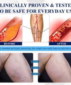 NovaRX® NerveRelief LC Medical Treatment Cream