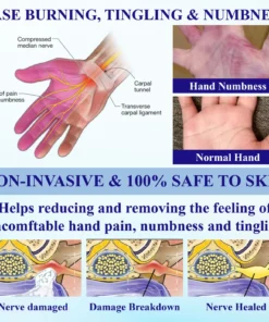 NovaRX® NumbAway CoolEase Neuropathy Spray