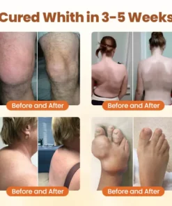 NovaRX® Premium Curcumin Pain Relief Gel
