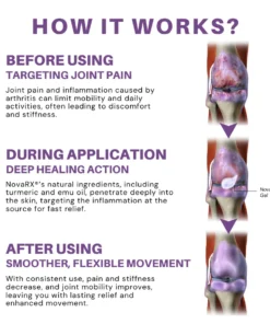 NovaRX® Turmeric & Emu Oil Arthritis Soothing Pain Relief Gel