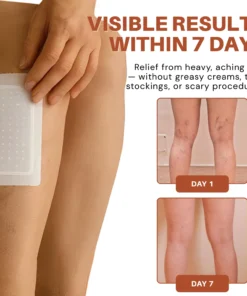 NovaRX® VeinTarget Nanotech Microneedle Patch
