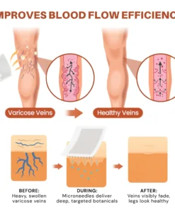NovaRX® VeinTarget Nanotech Microneedle Patch