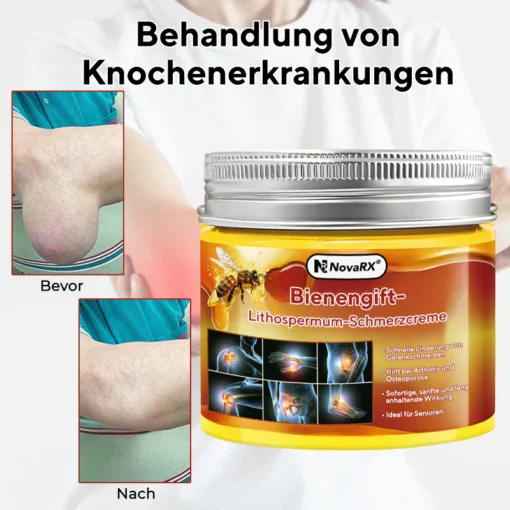 NovaRX® Bienengift-Lithospermum-Schmerzcreme - Image 3