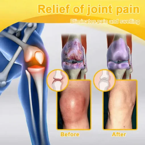 NovaRX® Bee Venom Pain-Relief Joint Soothing Spray