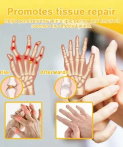 NovaRX® Bee Venom Pain-Relief Joint Soothing Spray