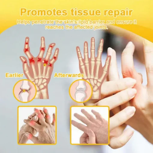 NovaRX® Bee Venom Pain-Relief Joint Soothing Spray
