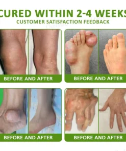 NovaRX® Magnesium & Peppermint Arthritis Pain Relief and Bone Healing Cream