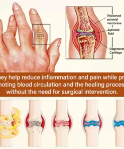 NovaRX® VenomEase Joint Cream